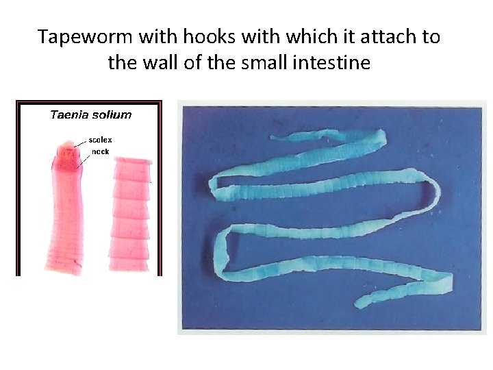 Tapeworm with hooks with which it attach to the wall of the small intestine