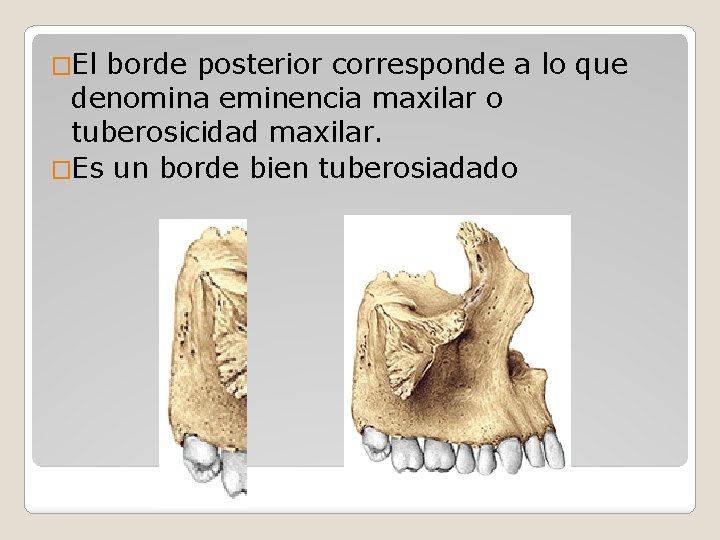 �El borde posterior corresponde a lo que denomina eminencia maxilar o tuberosicidad maxilar. �Es