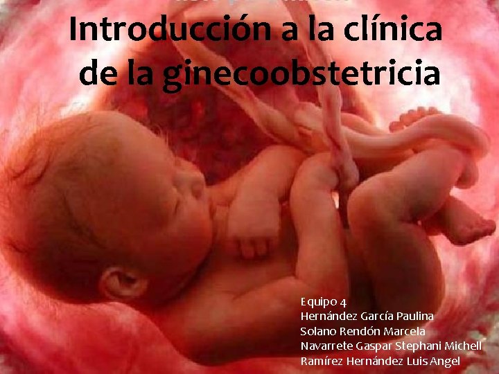 Introducción a la clínica de la ginecoobstetricia Equipo 4 Hernández García Paulina Solano Rendón