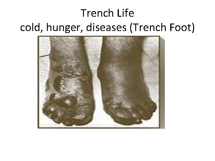 Trench Life cold, hunger, diseases (Trench Foot) Trench Life cold, hunger, diseases (Trench Foot)