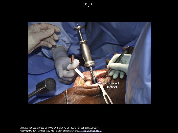 Fig 6 Arthroscopy Techniques 2017 6 e 1703 -e 1707 DOI: (10. 1016/j. eats.