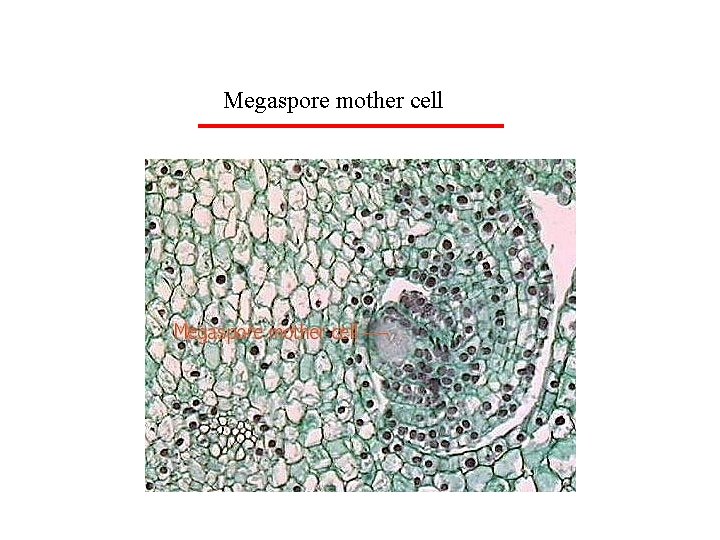 Megaspore mother cell 