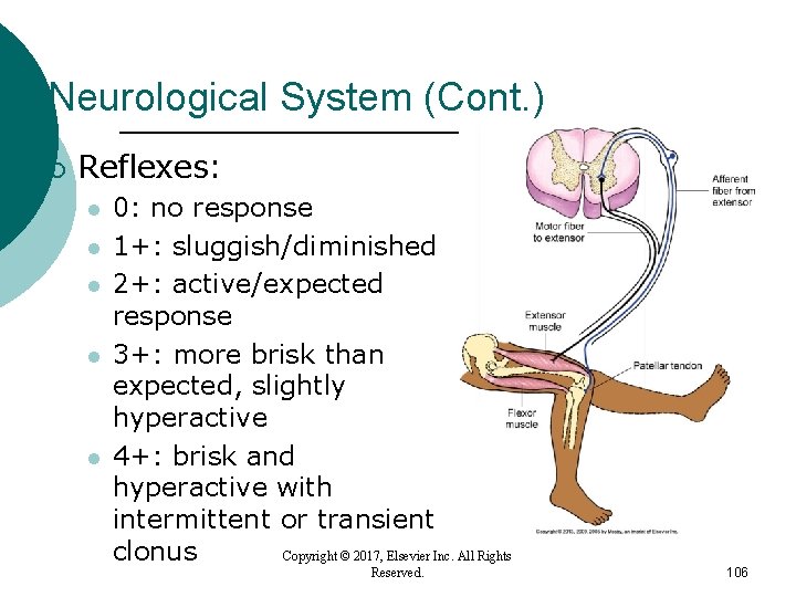 Neurological System (Cont. ) ¡ Reflexes: l l l 0: no response 1+: sluggish/diminished Neurological System (Cont. ) ¡ Reflexes: l l l 0: no response 1+: sluggish/diminished
