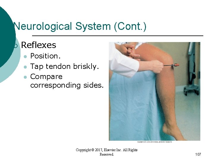 Neurological System (Cont. ) ¡ Reflexes l l l Position. Tap tendon briskly. Compare Neurological System (Cont. ) ¡ Reflexes l l l Position. Tap tendon briskly. Compare