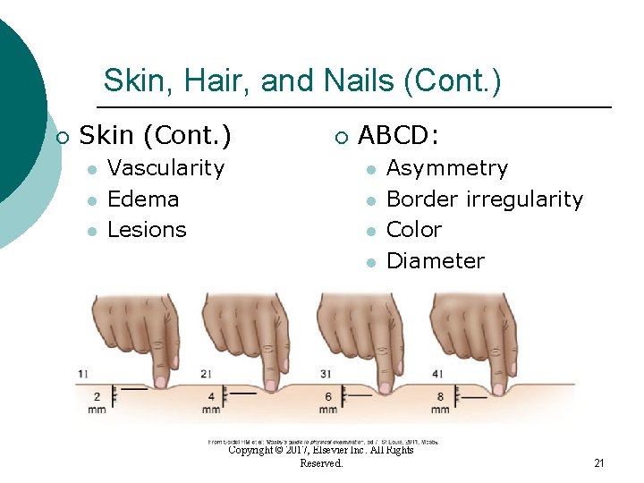Skin, Hair, and Nails (Cont. ) ¡ Skin (Cont. ) l l l Vascularity Skin, Hair, and Nails (Cont. ) ¡ Skin (Cont. ) l l l Vascularity