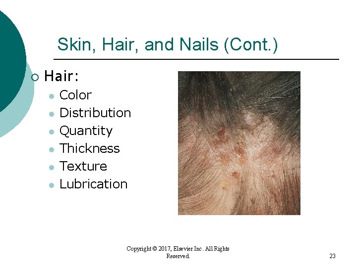 Skin, Hair, and Nails (Cont. ) ¡ Hair: l l l Color Distribution Quantity Skin, Hair, and Nails (Cont. ) ¡ Hair: l l l Color Distribution Quantity