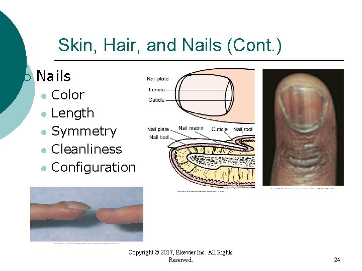 Skin, Hair, and Nails (Cont. ) ¡ Nails l l l Color Length Symmetry Skin, Hair, and Nails (Cont. ) ¡ Nails l l l Color Length Symmetry
