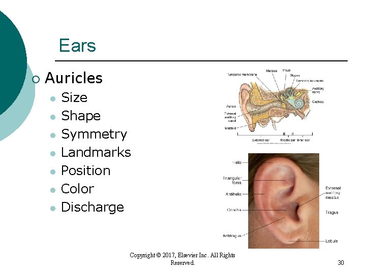 Ears ¡ Auricles l l l l Size Shape Symmetry Landmarks Position Color Discharge Ears ¡ Auricles l l l l Size Shape Symmetry Landmarks Position Color Discharge