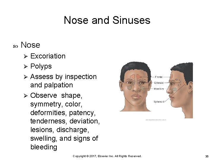 Nose and Sinuses Nose Excoriation Ø Polyps Ø Assess by inspection and palpation Ø Nose and Sinuses Nose Excoriation Ø Polyps Ø Assess by inspection and palpation Ø