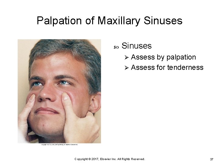 Palpation of Maxillary Sinuses Assess by palpation Ø Assess for tenderness Ø Copyright © Palpation of Maxillary Sinuses Assess by palpation Ø Assess for tenderness Ø Copyright ©