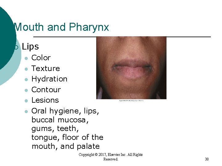Mouth and Pharynx ¡ Lips l l l Color Texture Hydration Contour Lesions Oral Mouth and Pharynx ¡ Lips l l l Color Texture Hydration Contour Lesions Oral