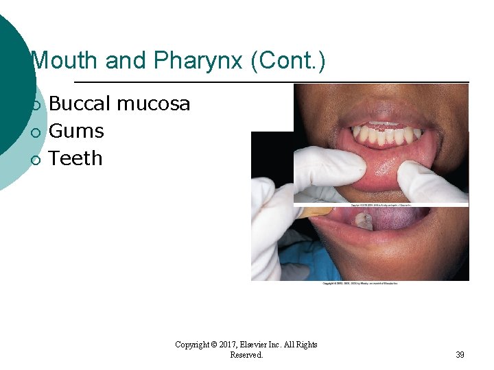 Mouth and Pharynx (Cont. ) ¡ ¡ ¡ Buccal mucosa Gums Teeth Copyright © Mouth and Pharynx (Cont. ) ¡ ¡ ¡ Buccal mucosa Gums Teeth Copyright ©