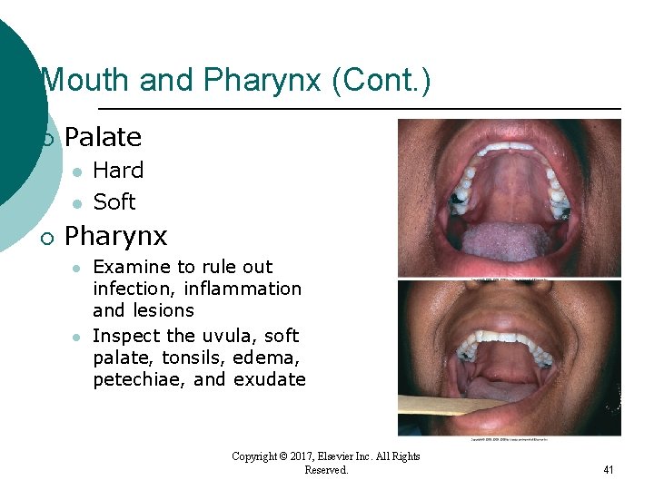 Mouth and Pharynx (Cont. ) ¡ Palate l l ¡ Hard Soft Pharynx l Mouth and Pharynx (Cont. ) ¡ Palate l l ¡ Hard Soft Pharynx l