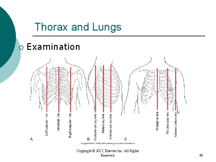 Thorax and Lungs ¡ Examination Copyright © 2017, Elsevier Inc. All Rights Reserved. 46 Thorax and Lungs ¡ Examination Copyright © 2017, Elsevier Inc. All Rights Reserved. 46