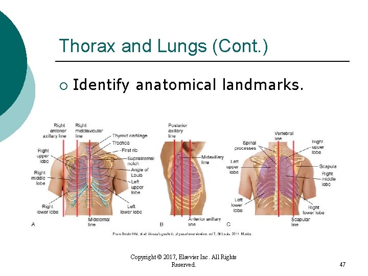 Thorax and Lungs (Cont. ) ¡ Identify anatomical landmarks. Copyright © 2017, Elsevier Inc. Thorax and Lungs (Cont. ) ¡ Identify anatomical landmarks. Copyright © 2017, Elsevier Inc.