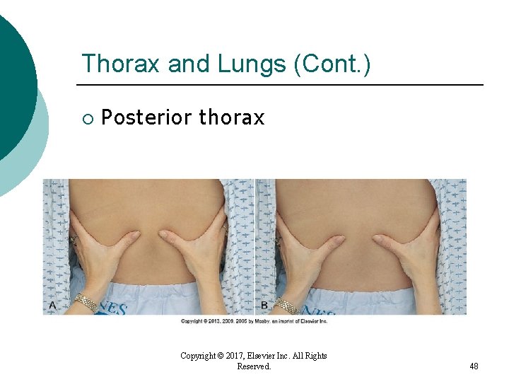 Thorax and Lungs (Cont. ) ¡ Posterior thorax Copyright © 2017, Elsevier Inc. All Thorax and Lungs (Cont. ) ¡ Posterior thorax Copyright © 2017, Elsevier Inc. All