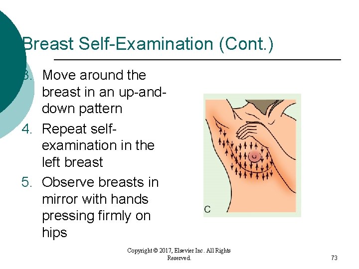 Breast Self-Examination (Cont. ) 3. Move around the breast in an up-anddown pattern 4. Breast Self-Examination (Cont. ) 3. Move around the breast in an up-anddown pattern 4.