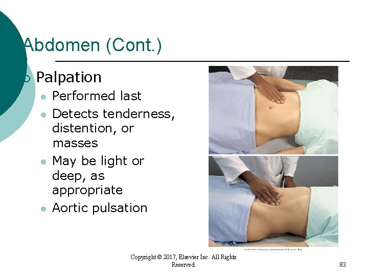 Abdomen (Cont. ) ¡ Palpation l l Performed last Detects tenderness, distention, or masses Abdomen (Cont. ) ¡ Palpation l l Performed last Detects tenderness, distention, or masses