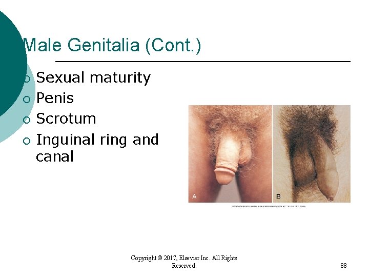 Male Genitalia (Cont. ) ¡ ¡ Sexual maturity Penis Scrotum Inguinal ring and canal Male Genitalia (Cont. ) ¡ ¡ Sexual maturity Penis Scrotum Inguinal ring and canal