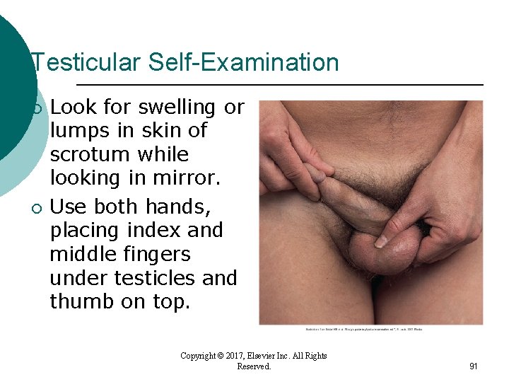 Testicular Self-Examination ¡ ¡ Look for swelling or lumps in skin of scrotum while Testicular Self-Examination ¡ ¡ Look for swelling or lumps in skin of scrotum while