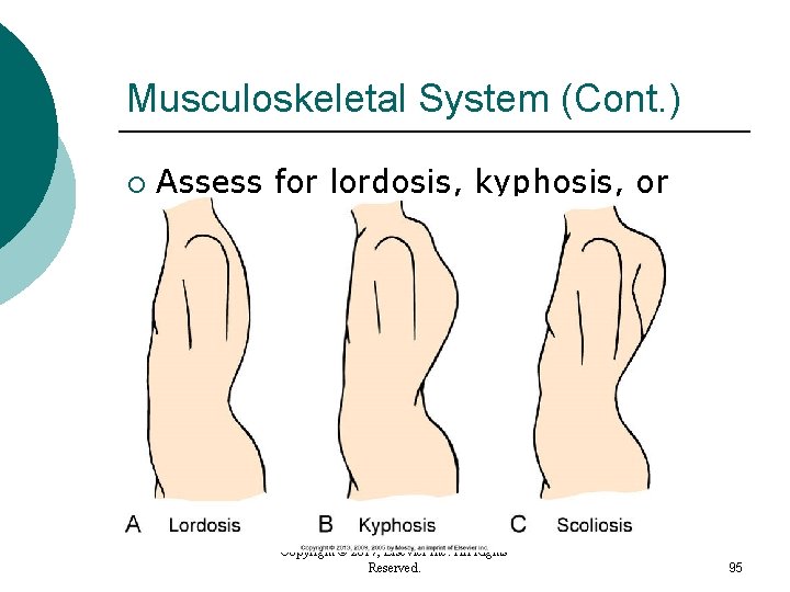 Musculoskeletal System (Cont. ) ¡ Assess for lordosis, kyphosis, or scoliosis. Copyright © 2017, Musculoskeletal System (Cont. ) ¡ Assess for lordosis, kyphosis, or scoliosis. Copyright © 2017,