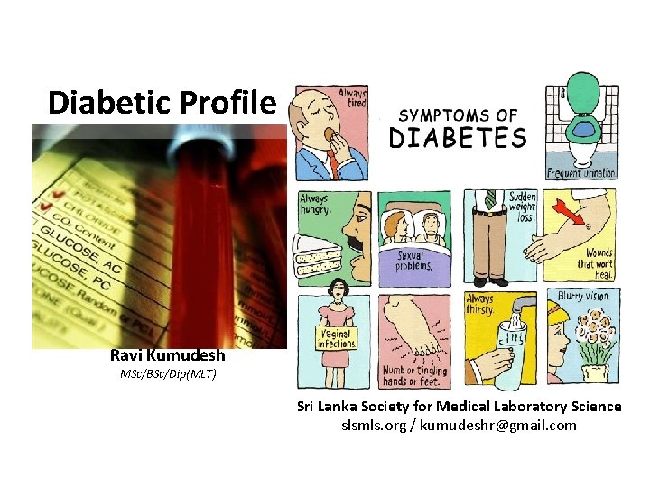 Diabetic Profile Ravi Kumudesh MSc/BSc/Dip(MLT) Sri Lanka Society for Medical Laboratory Science slsmls. org