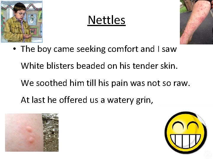 Nettles • The boy came seeking comfort and I saw White blisters beaded on