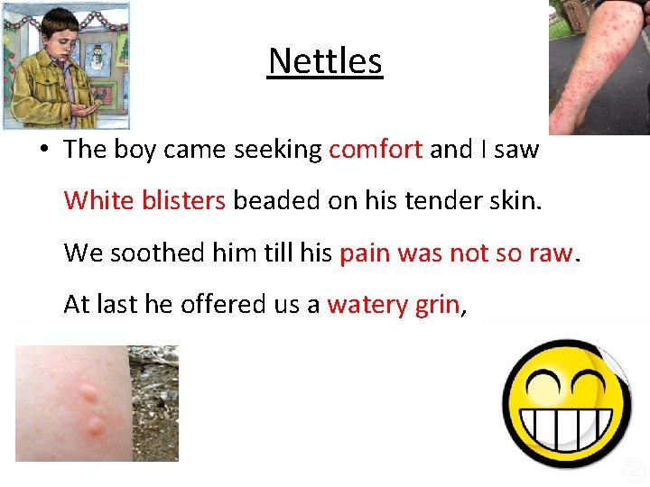 Nettles • The boy came seeking comfort and I saw White blisters beaded on