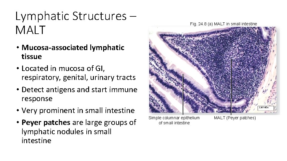 Lymphatic Structures – MALT • Mucosa-associated lymphatic tissue • Located in mucosa of GI,