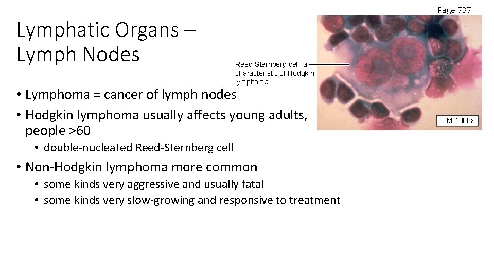 Lymphatic Organs – Lymph Nodes Page 737 Reed-Sternberg cell, a characteristic of Hodgkin lymphoma.