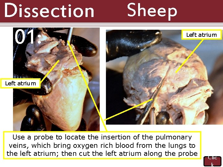 Dissection 101: Sheep Heart Left atrium Use a probe to locate the insertion of