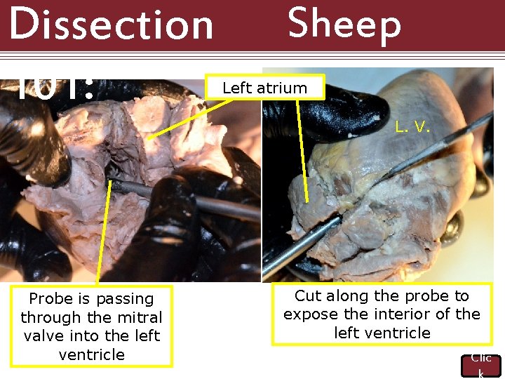 Dissection 101: Sheep Heart Left atrium L. V. Probe is passing through the mitral