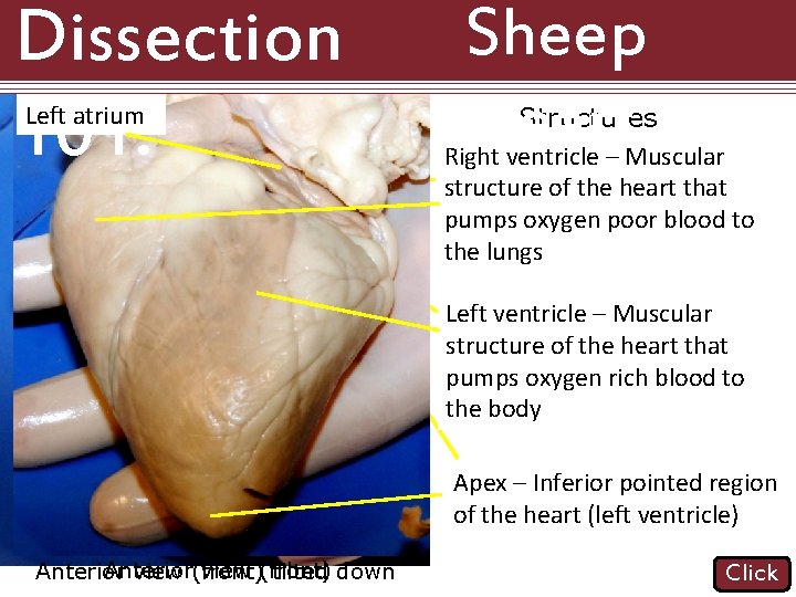 Dissection 101: Left atrium Sheep Heart Structures Right ventricle atrium (atria: – Muscular plural) Dissection 101: Left atrium Sheep Heart Structures Right ventricle atrium (atria: – Muscular plural)