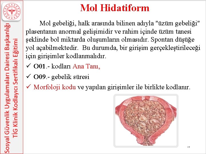 Mol Hidatiform Mol gebeliği, halk arasında bilinen adıyla "üzüm gebeliği" plasentanın anormal gelişimidir ve