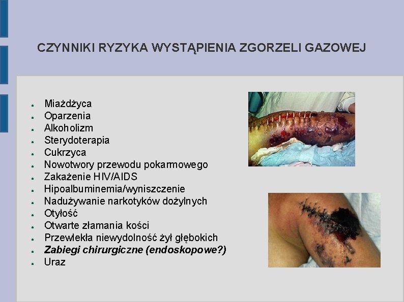 CZYNNIKI RYZYKA WYSTĄPIENIA ZGORZELI GAZOWEJ ● ● ● ● Miażdżyca Oparzenia Alkoholizm Sterydoterapia Cukrzyca