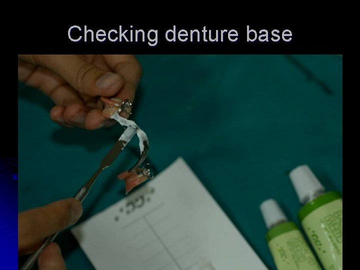 Checking denture base 