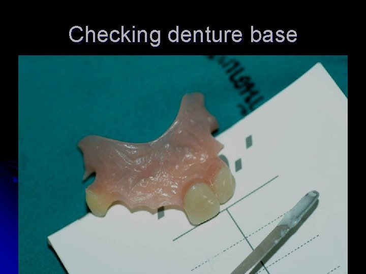 Checking denture base 