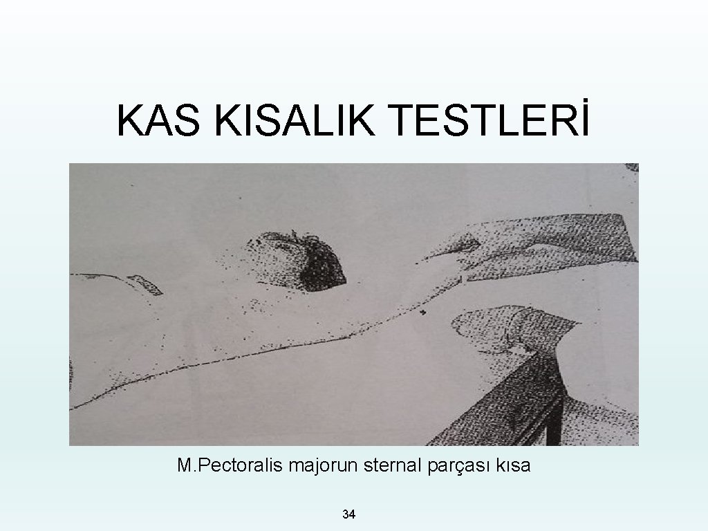 KAS KISALIK TESTLERİ M. Pectoralis majorun sternal parçası kısa 34 