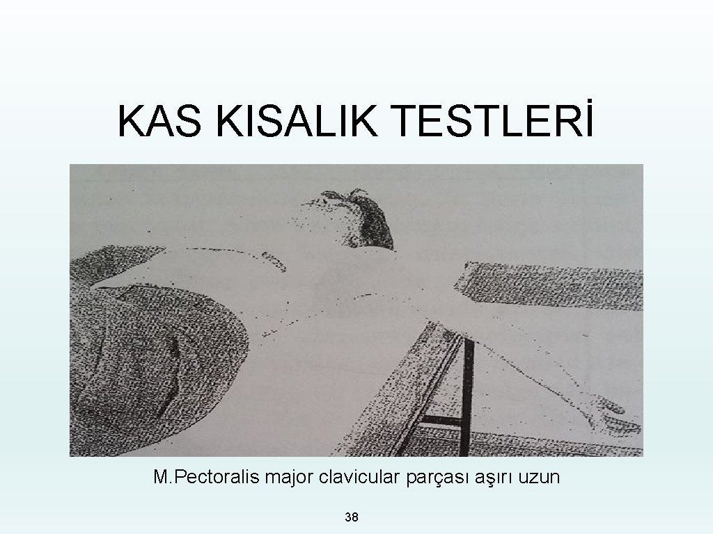 KAS KISALIK TESTLERİ M. Pectoralis major clavicular parçası aşırı uzun 38 
