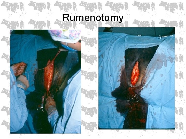 Rumenotomy 