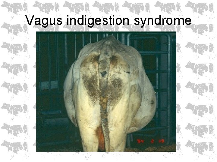 Vagus indigestion syndrome 