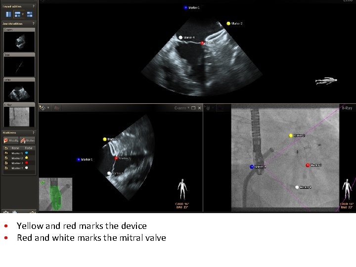 • Yellow and red marks the device • Red and white marks the • Yellow and red marks the device • Red and white marks the
