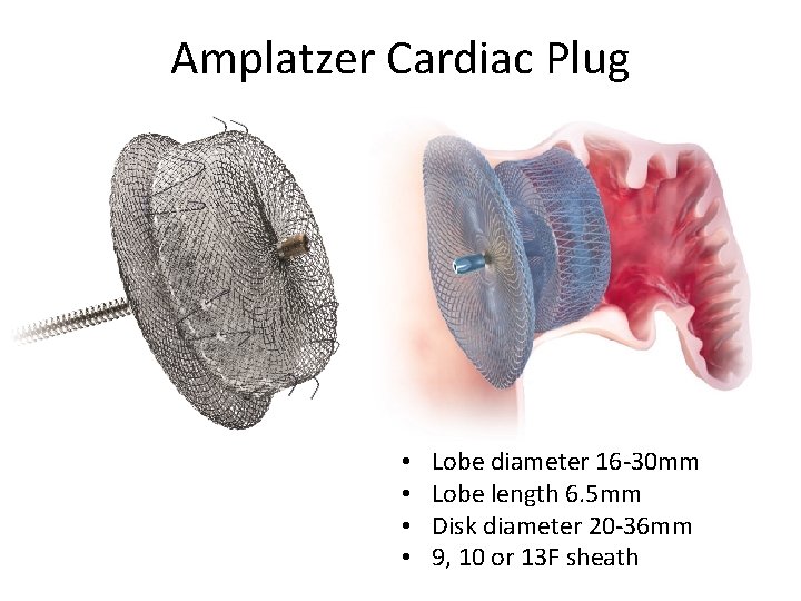 Amplatzer Cardiac Plug • • Lobe diameter 16 -30 mm Lobe length 6. 5 Amplatzer Cardiac Plug • • Lobe diameter 16 -30 mm Lobe length 6. 5