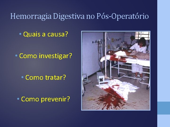 Hemorragia Digestiva no Pós-Operatório • Quais a causa? • Como investigar? • Como tratar?