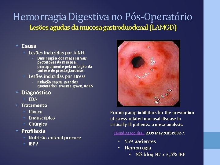 Hemorragia Digestiva no Pós-Operatório Lesões agudas da mucosa gastroduodenal (LAMGD) • Causa • Lesões