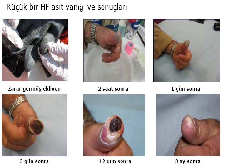 P. POLAT P. POLAT