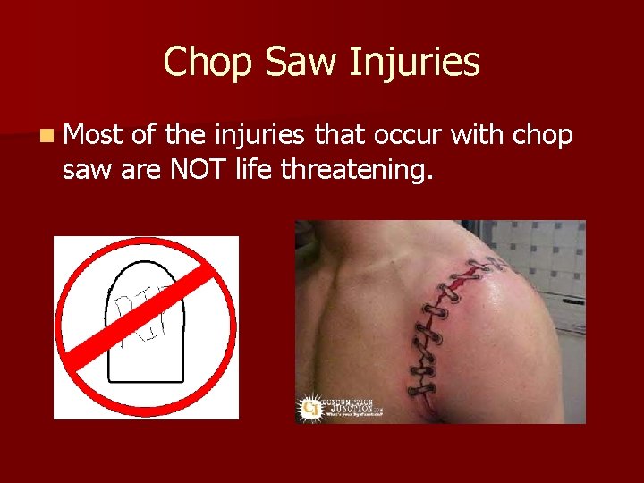 Chop Saw Injuries n Most of the injuries that occur with chop saw are