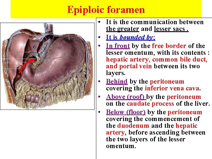 Epiploic foramen • It is the communication between the greater and lesser sacs. •