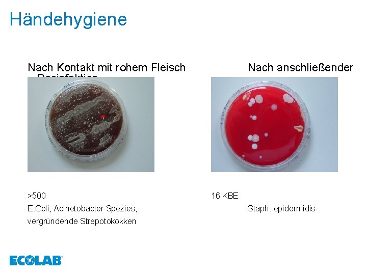 Händehygiene Nach Kontakt mit rohem Fleisch Desinfektion >500 E. Coli, Acinetobacter Spezies, vergründende Strepotokokken