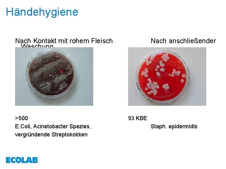 Händehygiene Nach Kontakt mit rohem Fleisch Waschung >500 E. Coli, Acinetobacter Spezies, vergründende Streptokokken